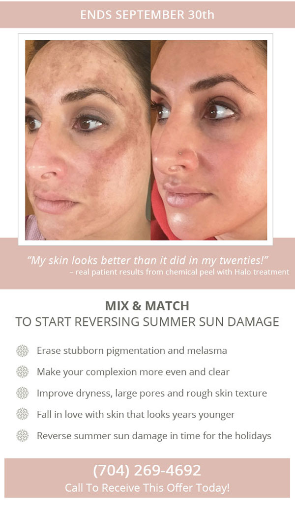 Sun Damage Showdown Promotion The Skin Center by CPS