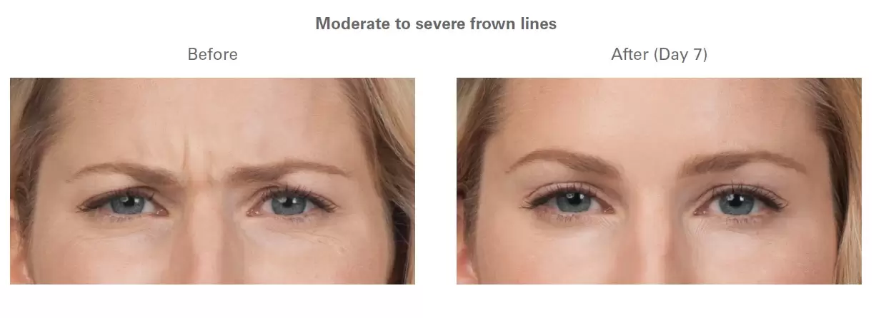 Liverpool Botox Aesthetics Clinic