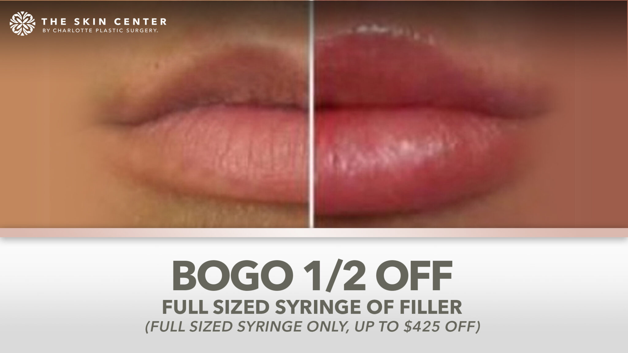 BOGO Lip Filler Limited Time Offer! The Skin Center by CPS