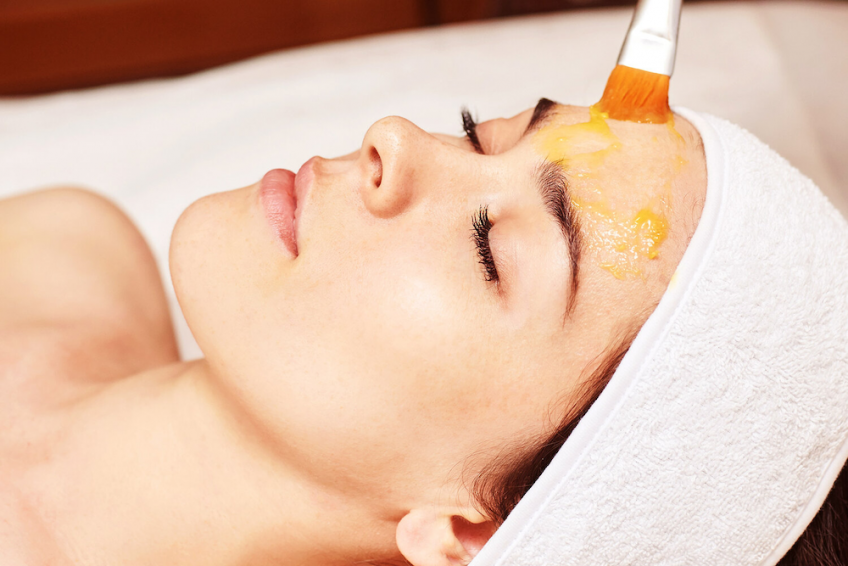 benefits of chemical peels