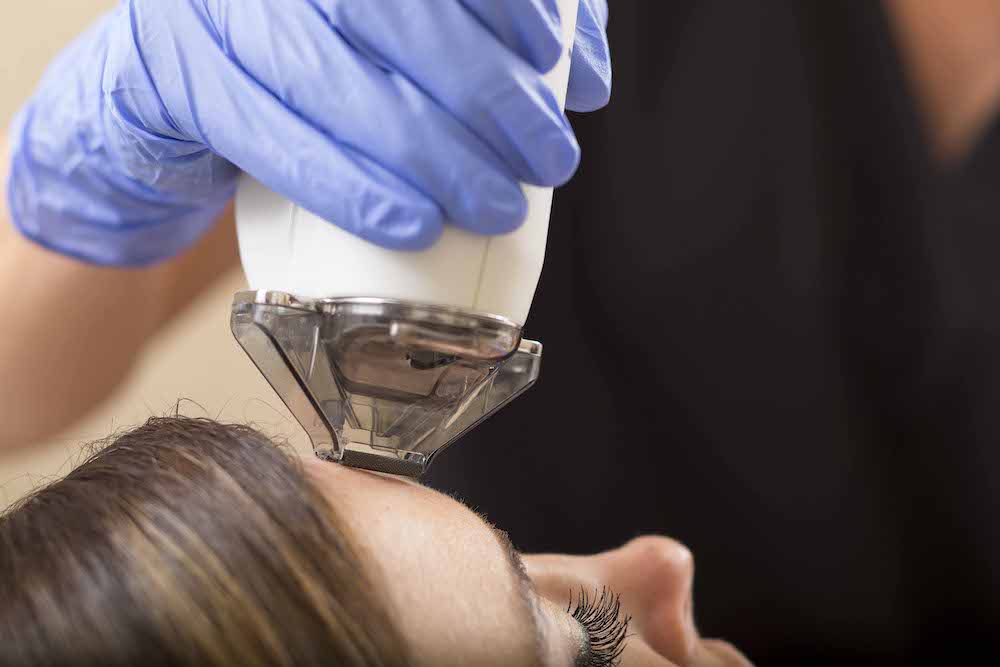 Myths About Laser Treatments