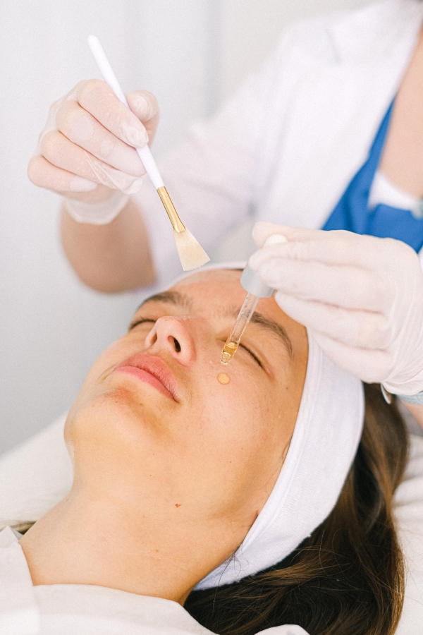 chemical peel process