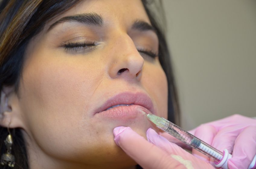 lip filler aftercare
