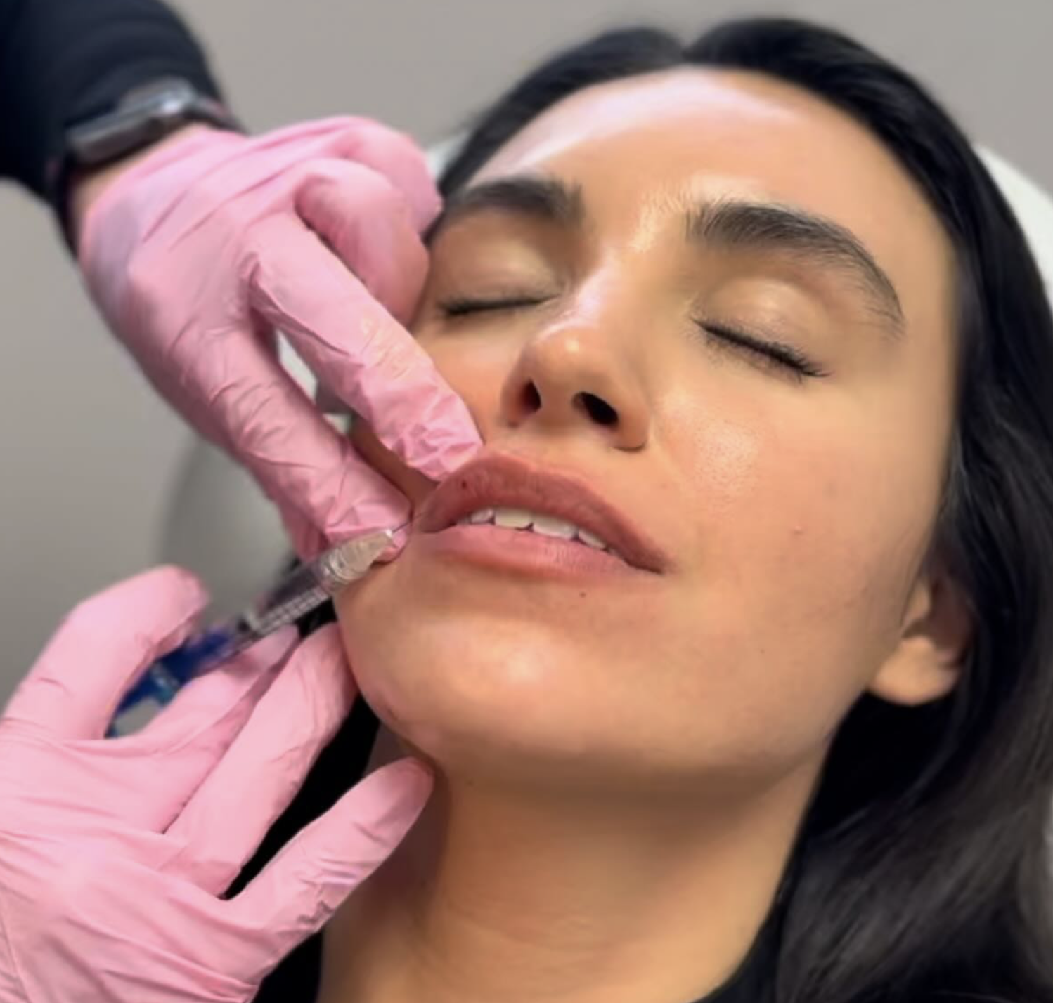 facial harmonization