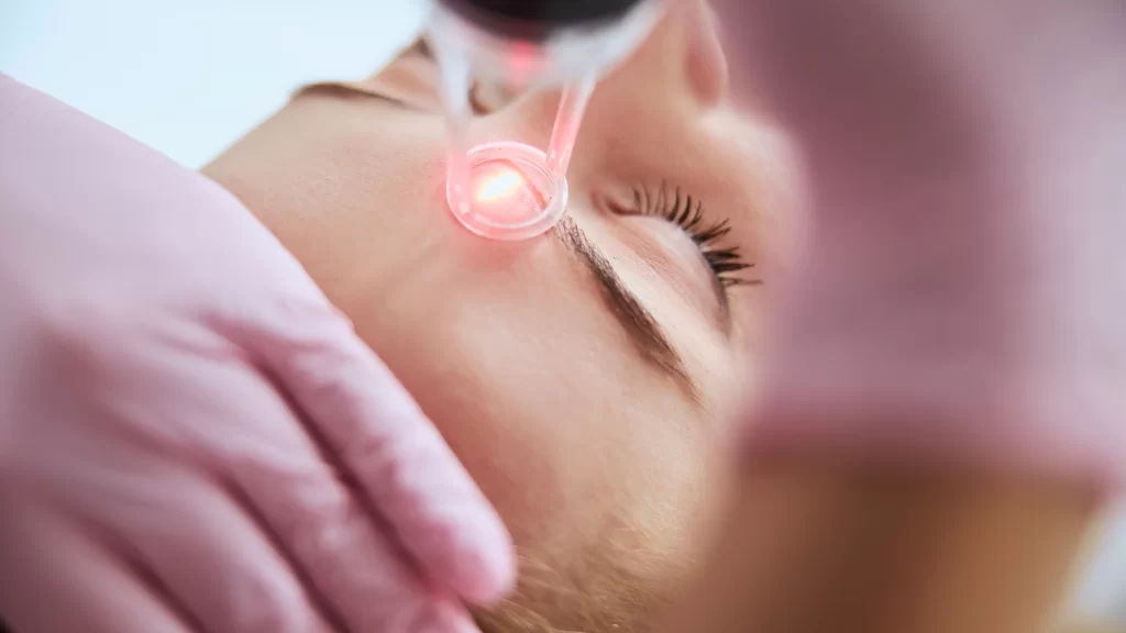 how to take care of your face after laser treatment